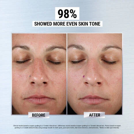 KIEHL'S Clearly Corrective Dark Spot Corrector - Buynowpakistan